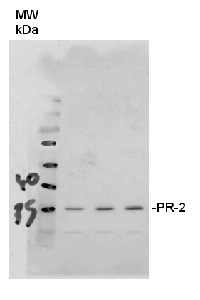 PR-2 | Pathogenesis-related protein 2 in the group Antibodies Plant/Algal / Environmental Stress / Pathogen attack at Agrisera AB (Antibodies for research) (AS12 2366)
